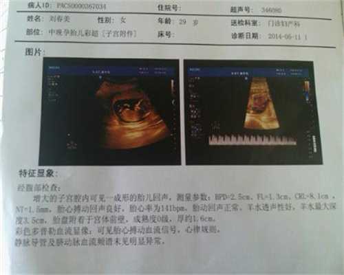 北京美国女人代孕：我做老公胎教的“试验田”
