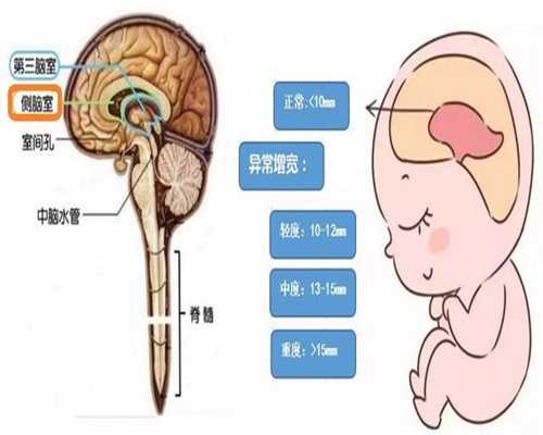 北京代孕育网站：教准代孕妈妈防辐射的妙招