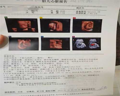 北京地下供卵：女性出现子宫肌瘤影响怀孕吗