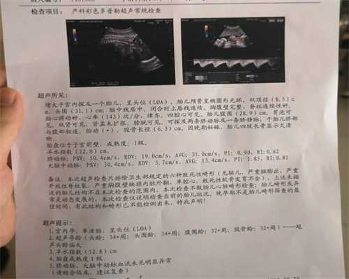 广州治疗多囊卵巢最好的医院