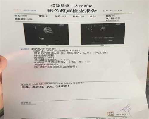 中国代孕公司：多囊卵巢综合征可以治愈