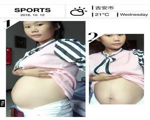 北京代孕一般多钱：多囊卵巢综合征怎么治