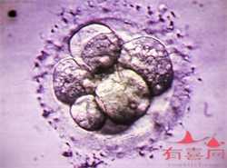 北京等供卵需要多长时间，输卵管狭窄可以供卵吗